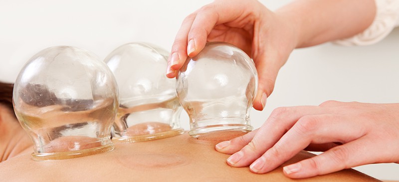 Cupping Therapy Benefits for Pain, Stiffness & Skin Health