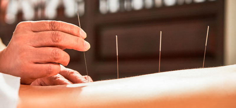 Understanding Acupuncture: An Ancient Healing Practice